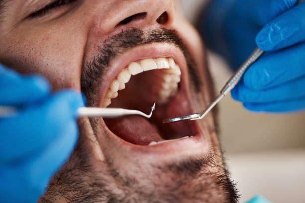 Best Emergency Tooth Extraction in North Vernon, IN