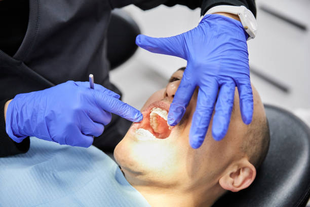 Best Emergency Wisdom Teeth Removal in North Vernon, IN